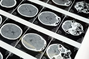 Brain imaging scans.